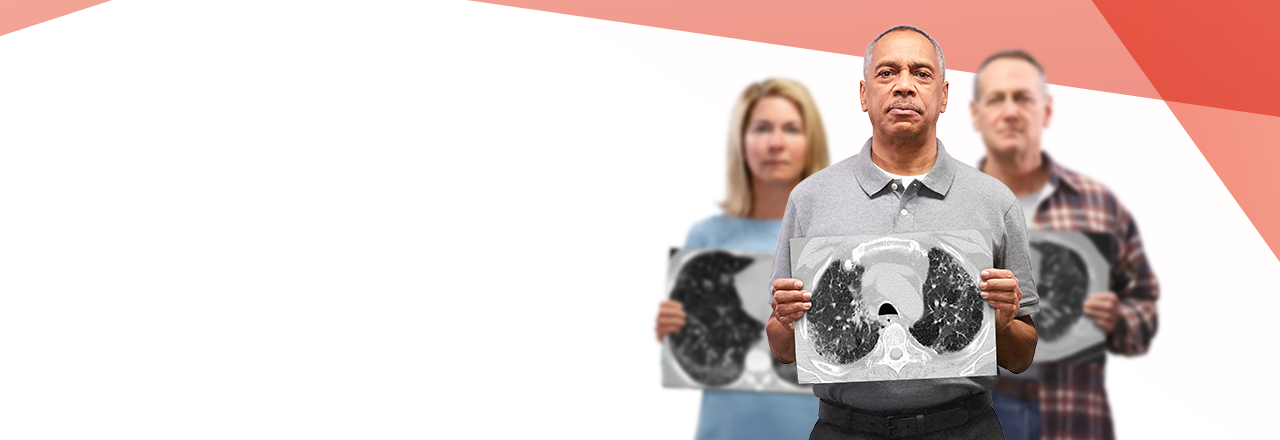 ILD patients with the HRCT scans in their hands.