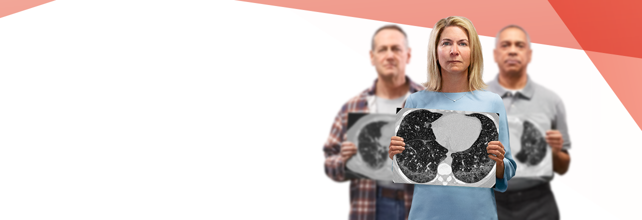 ILD patients with the HRCT scans in their hands.