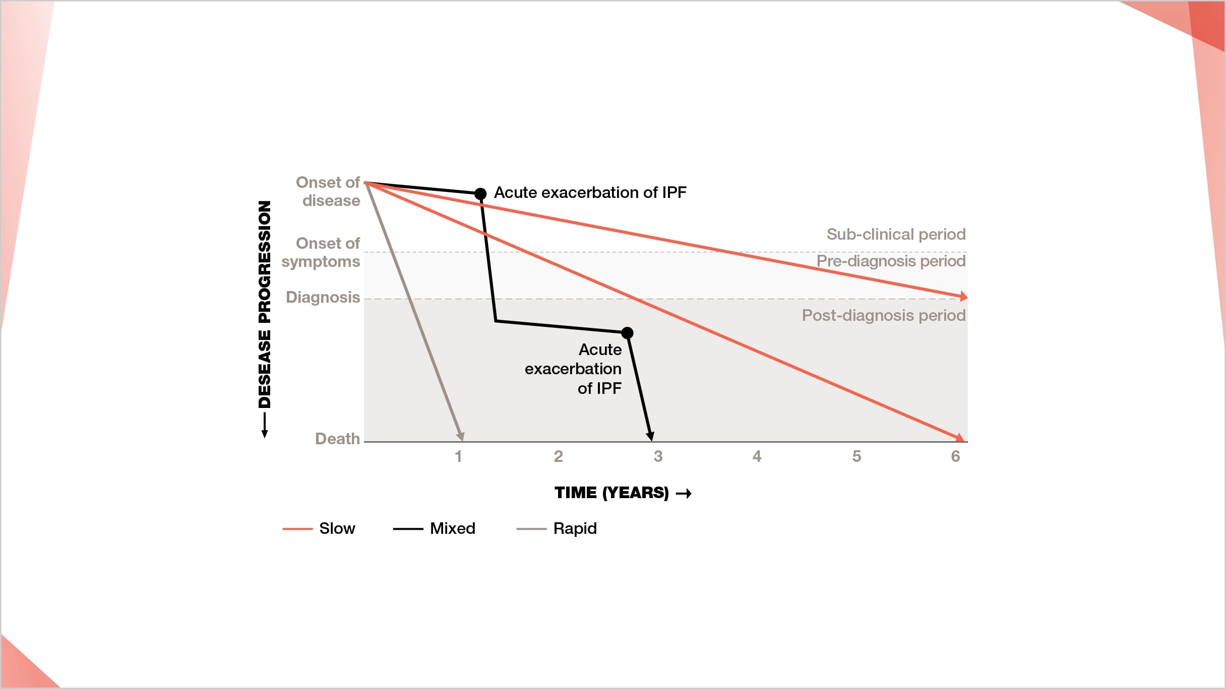 Acute exacerbation of IPF leads to poor survival