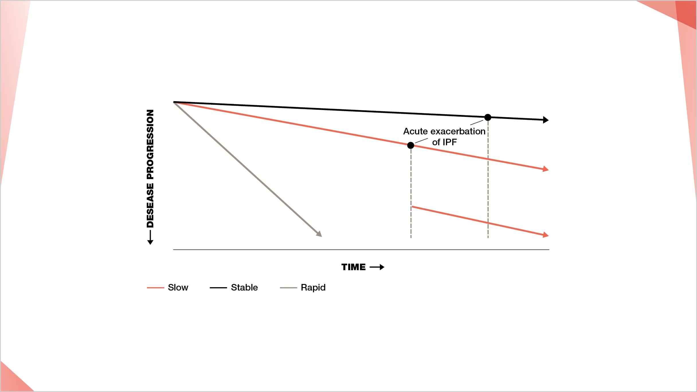 Rapid disease progression of IPF following acute exacerbation of IPF