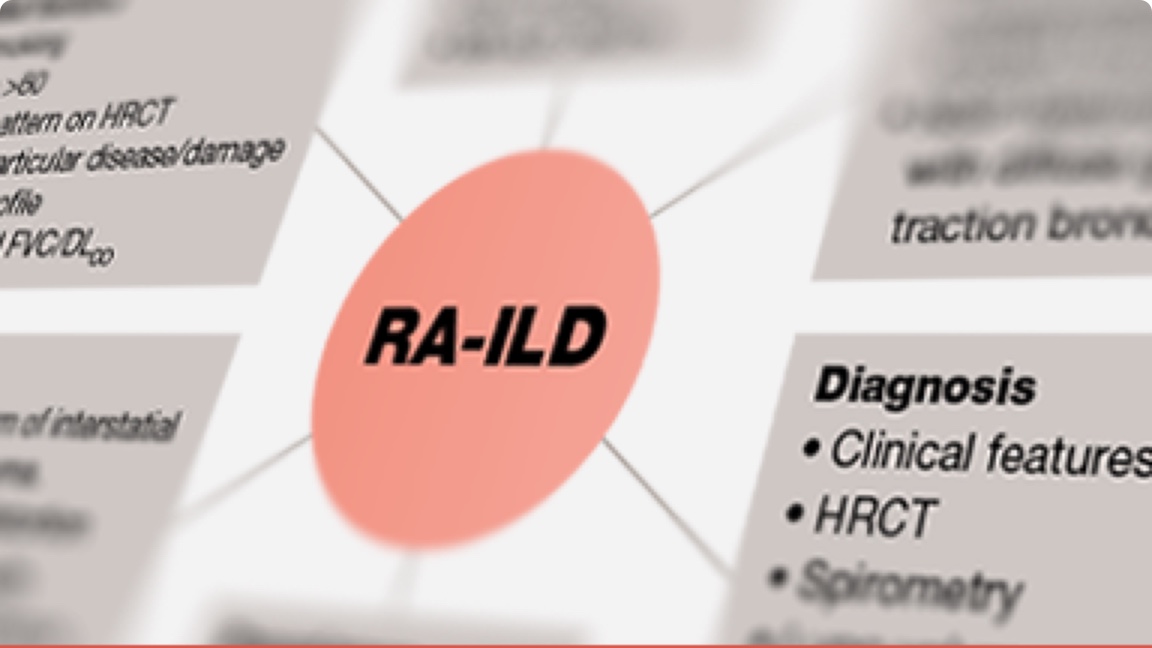 Diagnosis of RA-ILD