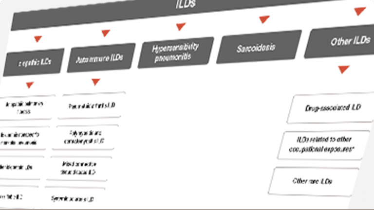 Recognizing pulmonary fibrosis is critical