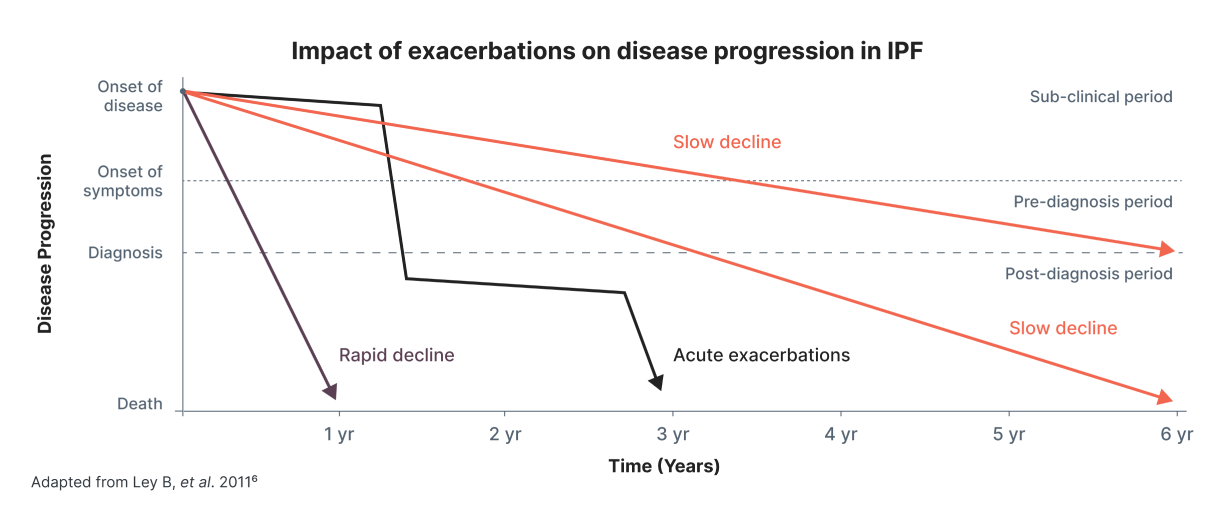 ILD Identification Strategies